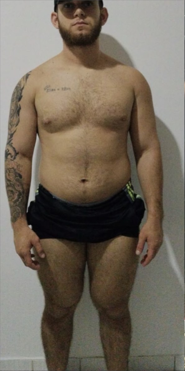 Antes